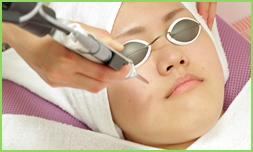 レーザーフェイシャル治療写真